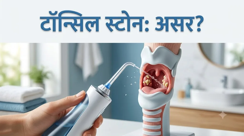 टॉन्सिल स्टोन के लिए वॉटर फ्लॉसर: क्या यह सचमुच काम करता है? 2 टॉन्सिल स्टोन