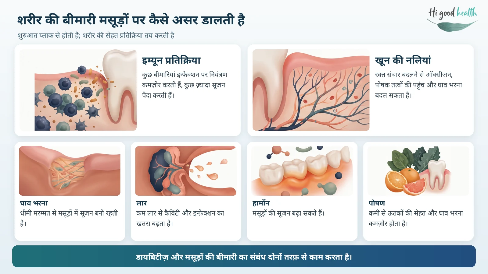 मसूड़े की सूजन, खून आना और मुंह सूखना: शरीर की बीमारियां मसूड़ों और मुंह की सेहत पर कैसे असर डालती हैं 4 शरीर की बीमारी मसूड़ों पर कैसे असर डालती है: इम्यून प्रतिक्रिया, खून की नलियां, घाव भरना, लार, हार्मोन और पोषण के ज़रिए