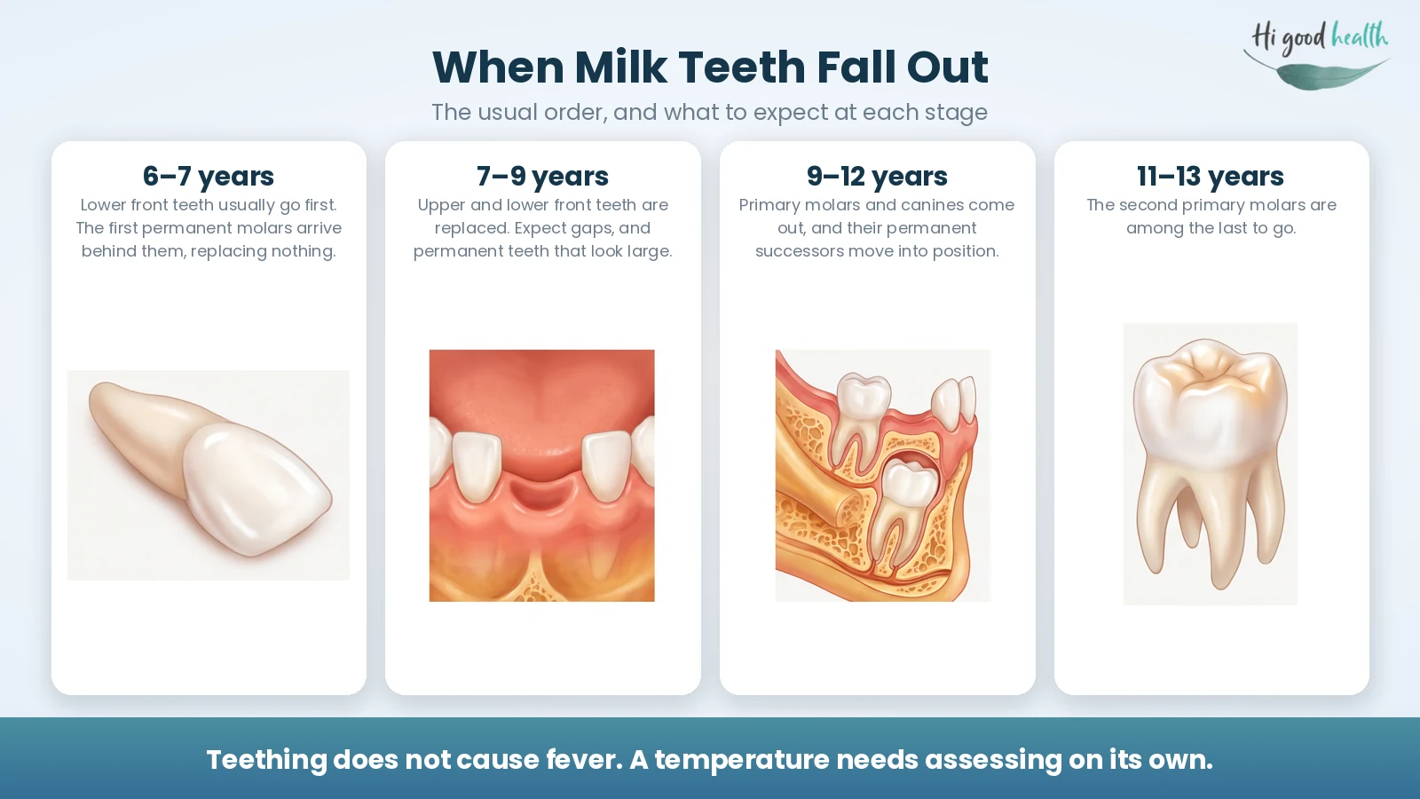 Milk Teeth Falling Out: Age, Order, Timeline, and What Indian Parents Should Know 3 Infographic in four stages showing when milk teeth fall out: at six to seven years the lower front teeth usually go first and the first permanent molars arrive behind them replacing nothing, at seven to nine the upper and lower front teeth are replaced, at nine to twelve primary molars and canines come out as their permanent successors move in, and at eleven to thirteen the second primary molars are among the last to go