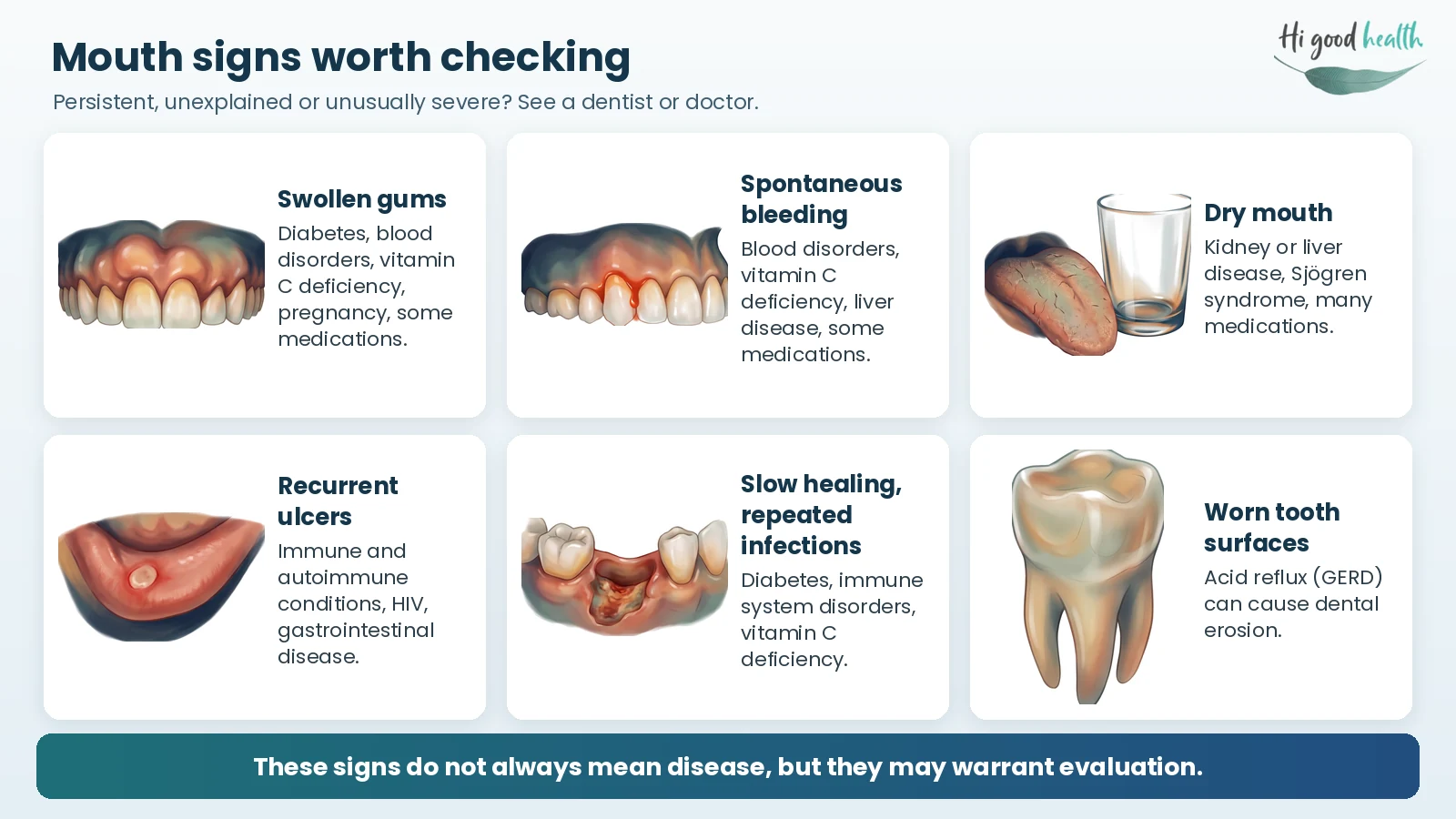 Mouth signs that can be linked to an underlying disease: swollen gums, spontaneous bleeding, dry mouth, recurrent ulcers, slow healing or repeated infections, and worn tooth surfaces